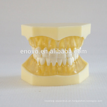 Modelo dental médico anatômico modelo 13013 da mandíbula da gengiva macia transparente anatômica